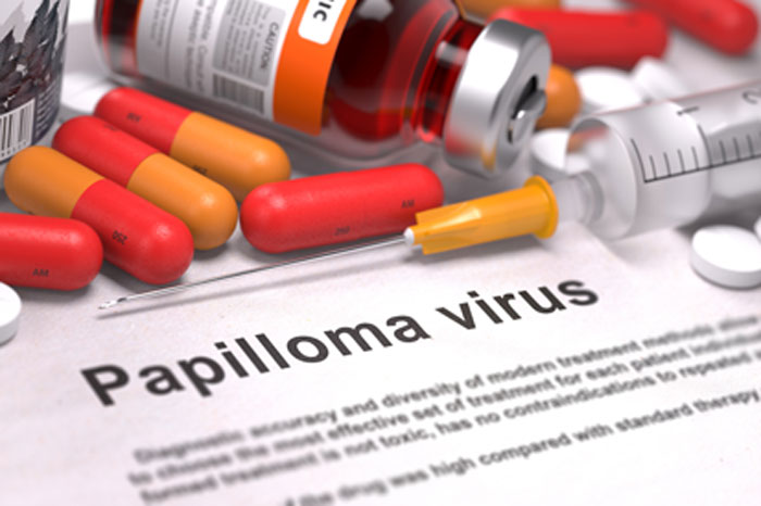 Spritze mit schlanker Kanüle, Glasflasche mit Impfstoff, rot-orange Kapseln und weiße Tabletten auf einem Papier mit der Aufschrift "Papilloma virus".